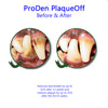 PlaqueOff Dental Supplement